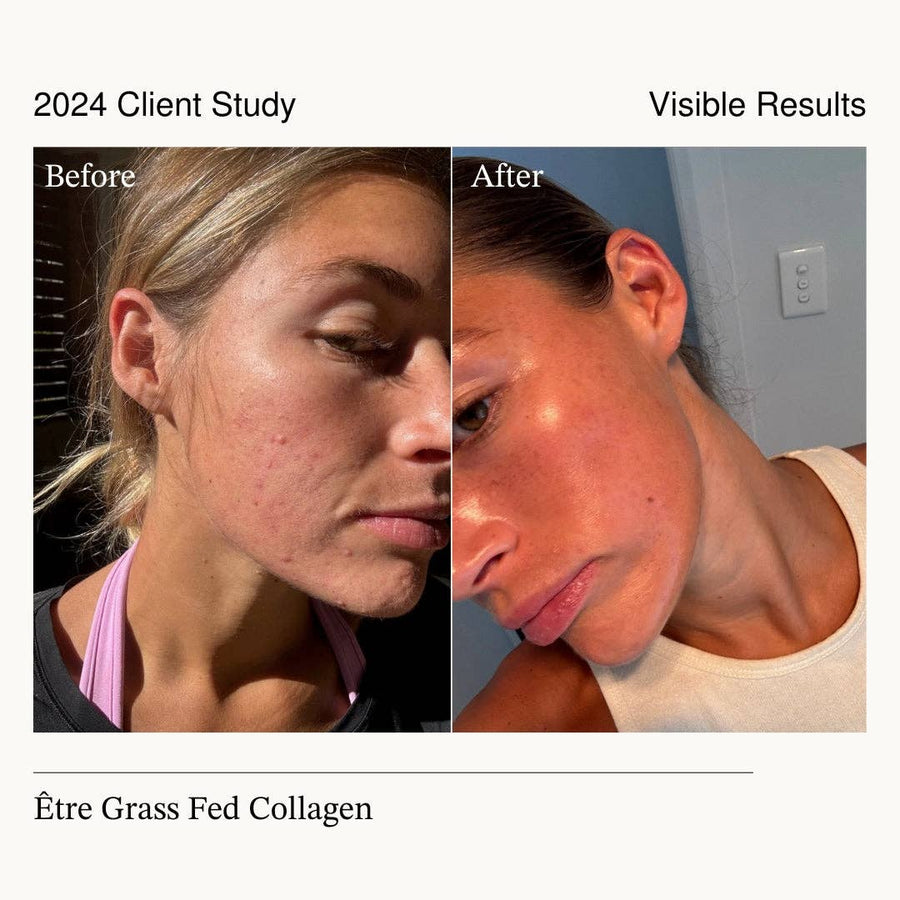 Etre Health Pty Ltd - Beauty & Digest | Grass Fed Collagen - STUDIO JO STORE  