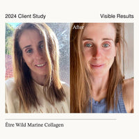 Thumbnail for Etre Health Pty Ltd Glow & Beauty Wild Marine Collagen supplement bottle with label and cap, natural health product for skin support